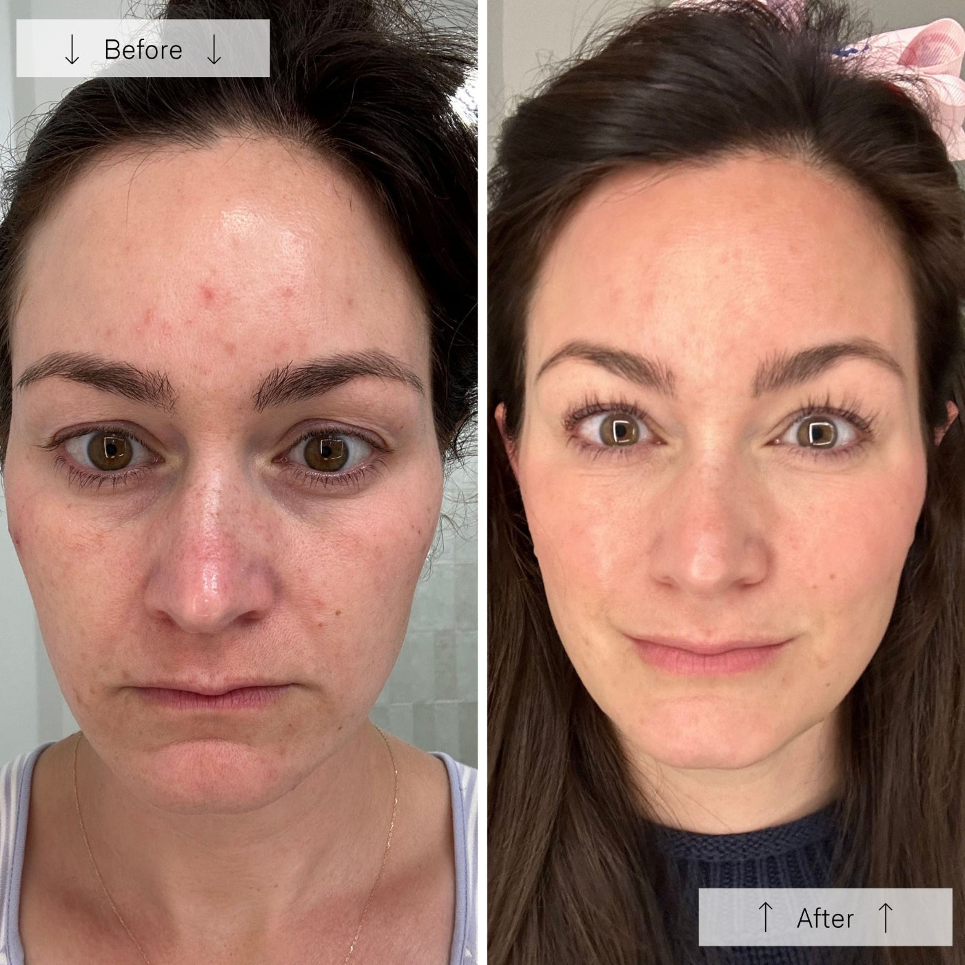 OmniLux Contour Mask