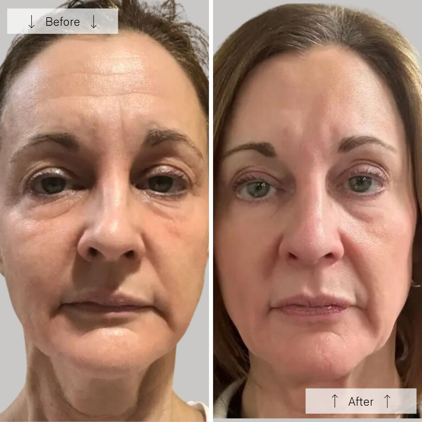 OmniLux Contour Mask