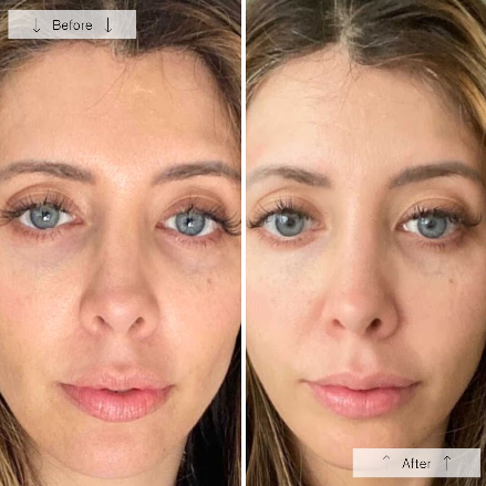 OmniLux Contour Mask