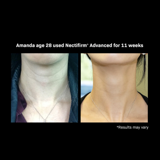 Nectifirm® Advanced